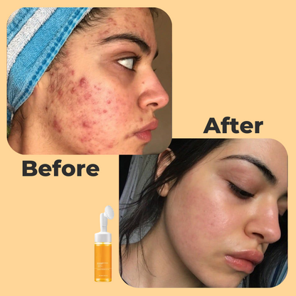 Turmeric and Kojic Acid cleanser